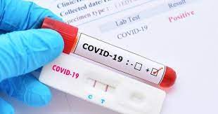 Bộ Y tế đồng ý sử dụng test nhanh để xác định người mắc Covid-19